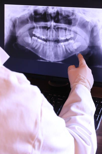 Best Emergency Root Canal Treatment in Ferndale, CA