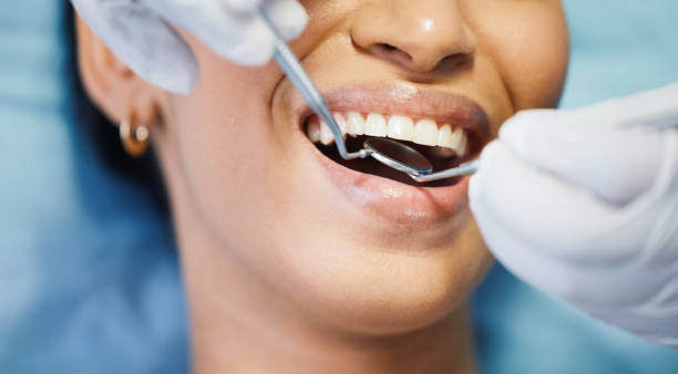 Best Emergency Denture Repair in Ferndale, CA