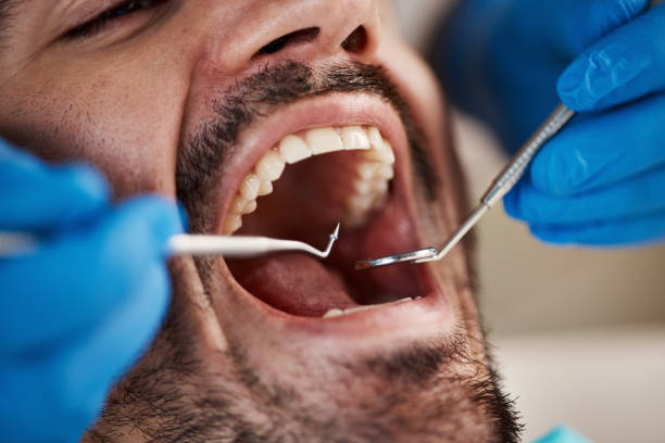 Best Same-Day Emergency Dental Services in Ferndale, CA